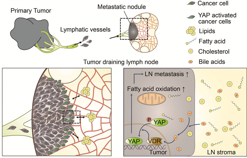 How Do Metastatic Tumor Cells Grow In Lymph Node