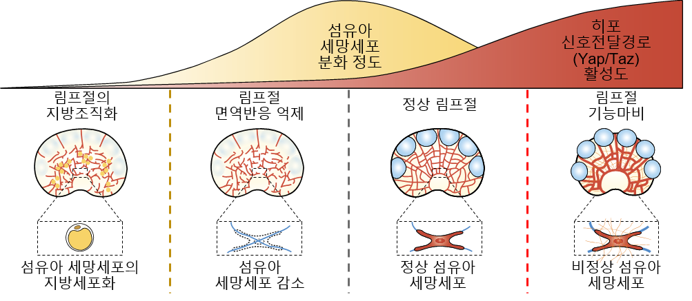 결합 조직 림프절