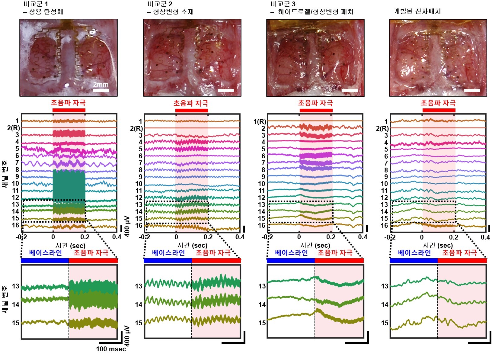 [그림 4] 연구진이 개발한 전자패치의 초음파 잡음 저항성 뇌파 계측 성능 평가를 위한 생체 내 비교 실험결과 
                      개발된 전자패치와 비교군 대뇌피질 전도 전극 소자(1. 상용 탄성 소재, 2. 접착 하이드로젤이 없는 신축성 형상변형 기판 소재, 3. 접착력이 없는 하이드로젤과 신축성 형상변형 기판이 함께 사용된 소재) 간의 쥐(rat) 대뇌 접촉면 사진이다. 마취된 쥐에 경두개 집속초음파로 신경 자극을 가해 대뇌피질전도를 모니터링한 결과, 비교군에 비해 새로운 전자패치는 초음파 잡음 없이 고품질의 뇌 신경 활동 반응 결과를 보였다.