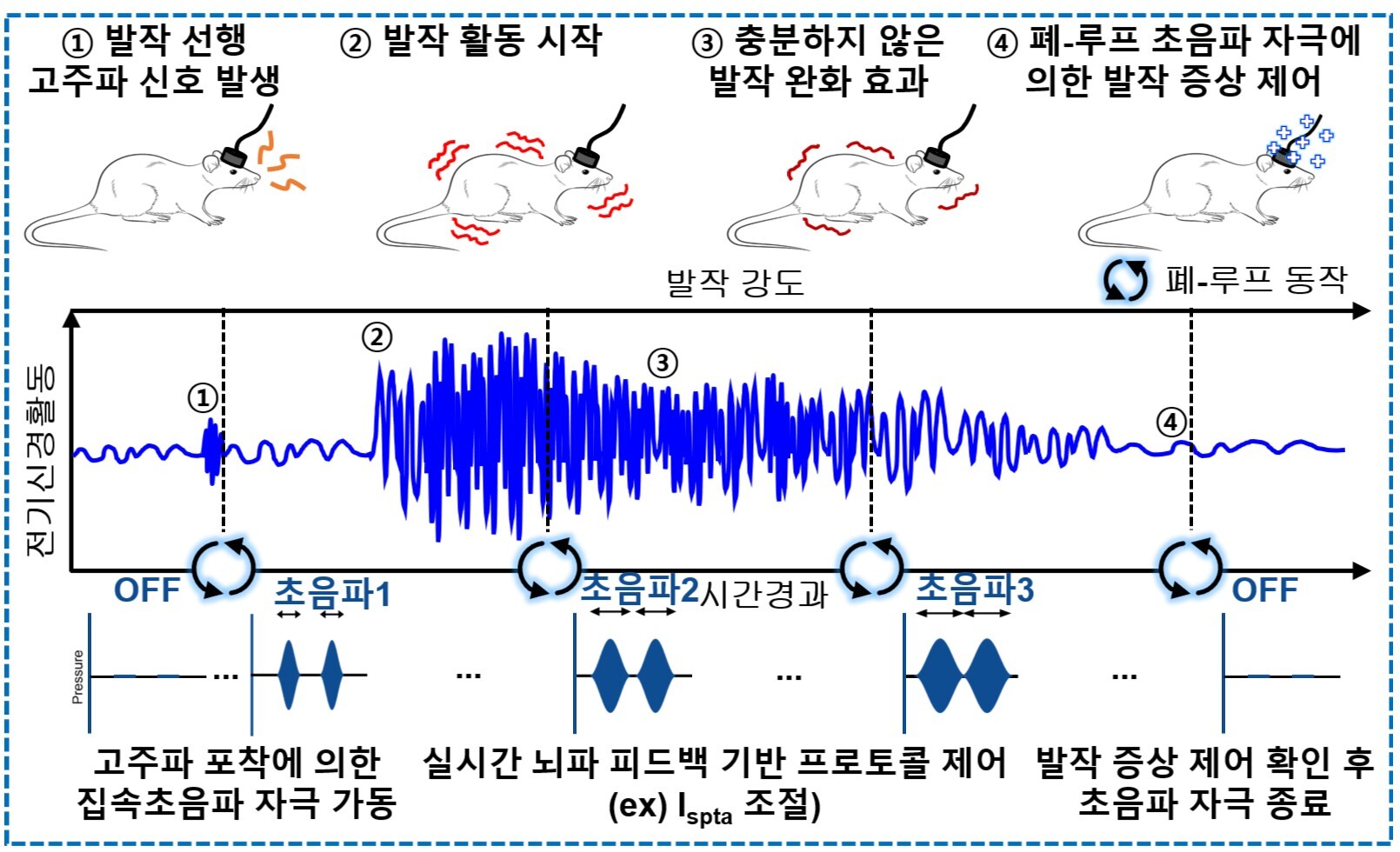 [그림 5] 전자패치-초음파 전자약의 뇌전증 제어 구현 
                          전자약 시스템은 형상변형 대뇌피질접착 신축성 전자패치와 소형 경두개 집속초음파 변환기로 구성된다. 먼저, 쥐의 머리에 전자패치를 부착하고 소형 경두개 집속초음파 변환기를 이식해, 무손실 대뇌피질전도 피드백 폐-루프 발작 제어가 가능하도록 전자약 시스템을 구성했다. 그리고 뇌전증을 유발한 쥐를 대상으로 16채널 전자패치를 이용해 대뇌피질전도를 실시간으로 모니터링했다. 고품질 뇌파 측정은 집속초음파 전자약의 3단계 강도 변조 중에도 안정적으로 가능했으며, 폐-루프 뇌전증 제어를 성공적으로 달성했다.