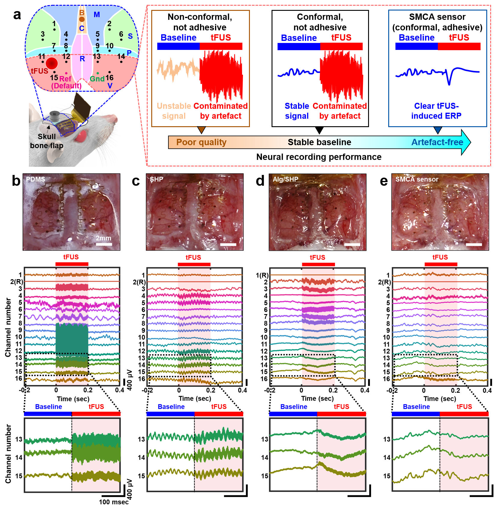 Figure 3. SMCA sensor allows for artefact-free neural recording
      A. Schematic image of the in vivo test for neural recording performance. M, motor; S, somatosensory; C, cingulate; R, retrosplenial; P, posterior parietal; V, visual; B, bregma; Ref, reference; Gnd, ground; B-E. Top-view images and corresponding timetrace plots of cortical activity from a representative trial of brain-mounted soft ECoG devices combined with 4 different materials, including PDMS B. SHP C. Alg (interface)/SHP (substrate) D. and SMCA (SMCA sensor) E. Magnified data plots of three consecutive channels, including a channel located on the visual cortex of the left hemisphere (Ch.15) directly stimulated by tFUS of each material platform.
      