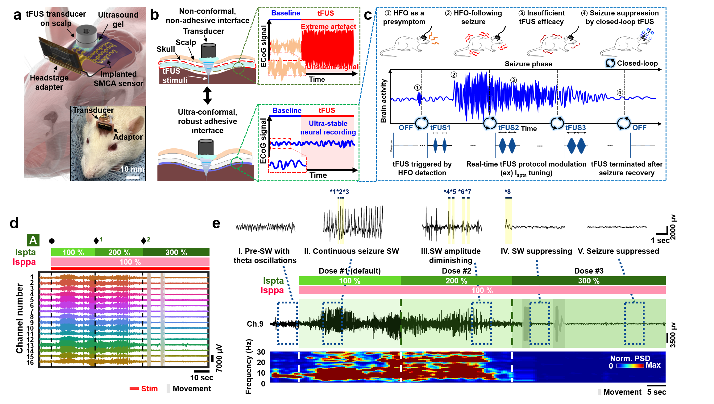 Figure 4. Closed-loop seizure control system capable of apposite tFUS modulation utilizing neurosignal feedback
      A. An illustration of the customized headstage system incorating with the SMCA sensor and a tFUS transducer for closed-loop neural recording and feedback neurostimulation. (Inset) A corresponding image shows the portable closed-loop therapeutic system applied to an awake freely moving rat. B. Schematics and corresponding conceptual plots of neural signals from the soft ECoG devices (top, the conventional device without tissue adhesion and conformability; bottom, the SMCA sensor) as a function of time under tFUS stimulation. C. Schematic illustrations of conceptual ECoG plot recorded from the SMCA sensor during closed-loop tFUS seizure suppression in an awake rodent model. D. Timetrace plot of 16-channel ECoG signals recorded from the SMCA sensor for a case of closed-loop seizure control based on 3-level tFUS protocol modulation, applied to the awake epileptic rodent model. E. Detailed ECoG trace from single-channel in the SMCA sensor during closed-loop seizure control. Magnified plots show 5-sec cropped neural activities corresponding to major phase of seizure epoch during closed-loop tFUS neurostimulation.
      