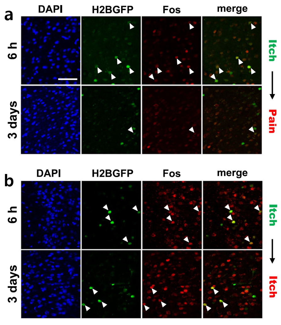 Figure 1. Visualization of Neurons Activated by Pain- and Itch-Inducing Stimuli