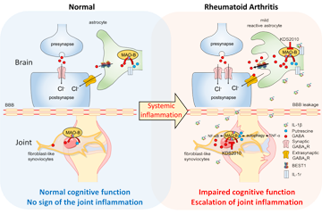 Two birds one stone strategy to treat both joint pain and cognitive impairment in rheumatoid arthritis