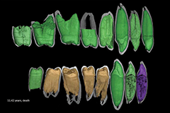 Synchrotron radiation sheds new light on the evolution of human childhood