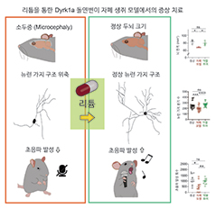 리튬, 자폐 스펙트럼 장애 치료의 새로운 열쇠 될까