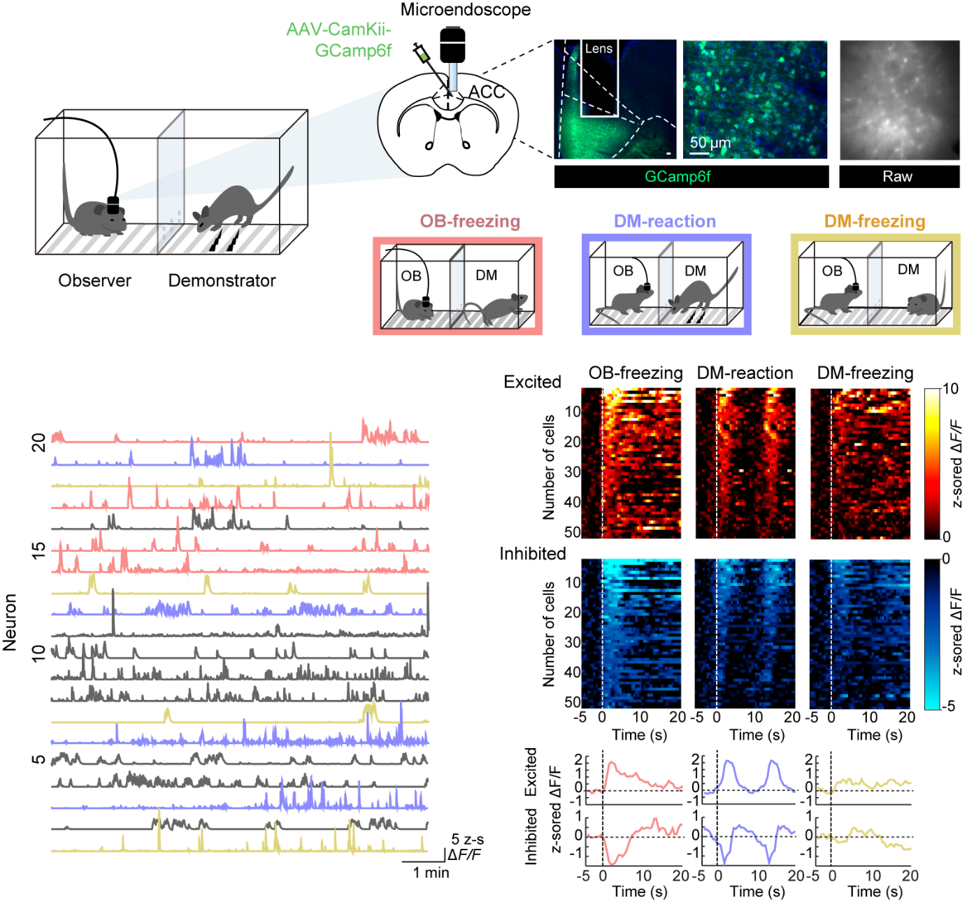 Decoding the Neural Basis of Affective Empathy: How the Brain Feels Others